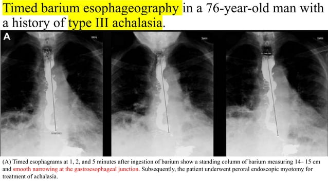 Imaging review Gastrointestinal motility disorders.pptx