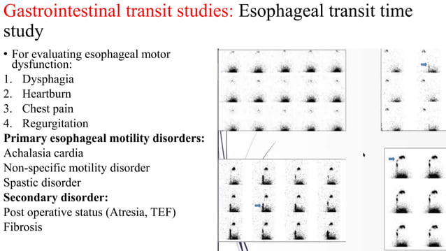 Imaging review Gastrointestinal motility disorders.pptx