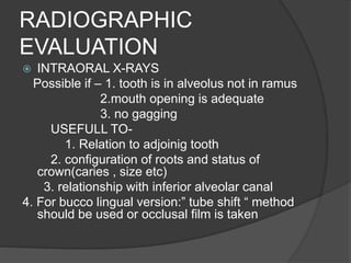 RADIOGRAPHIC
EVALUATION
 INTRAORAL X-RAYS
Possible if – 1. tooth is in alveolus not in ramus
2.mouth opening is adequate
3. no gagging
USEFULL TO-
1. Relation to adjoinig tooth
2. configuration of roots and status of
crown(caries , size etc)
3. relationship with inferior alveolar canal
4. For bucco lingual version:” tube shift “ method
should be used or occlusal film is taken
 