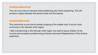 Underpostdamming
This can occur due to improper head-positioning and mouth positioning. This will
produce a space between the denture base and the tissues.
Overpostdamming
This commonly occurs due to excess scraping of the master cast. It occurs more
commonly in the hamular notch region.
• Mild overdamming in the hamular notch region can lead to tissue irritation of the
mucosa and excessive postdamming produces downward displacement of the denture
posteriorly
 
