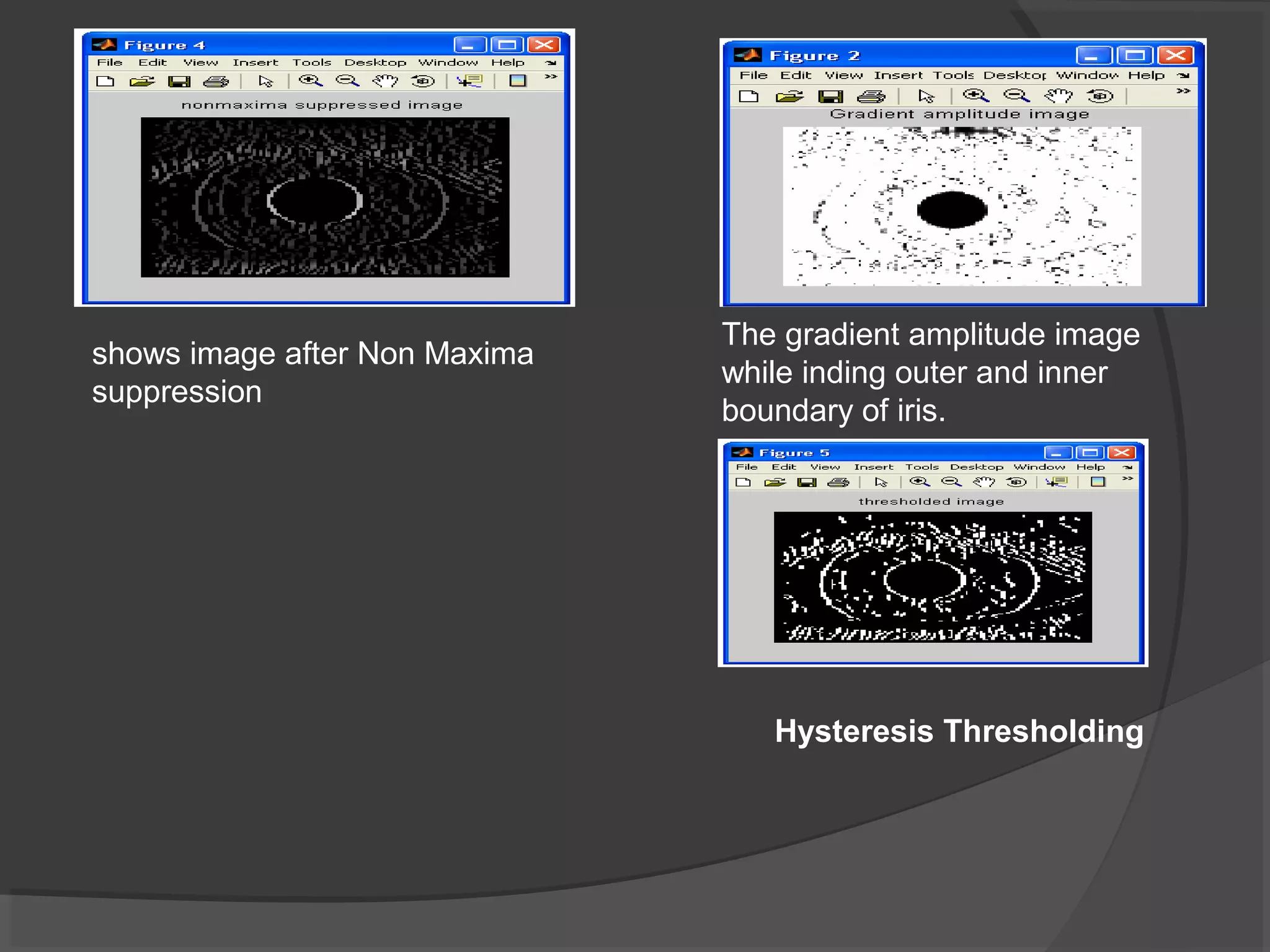The gradient amplitude image 
while inding outer and inner 
boundary of iris. 
shows image after Non Maxima 
suppression 
Hysteresis Thresholding 
 