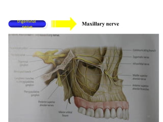 Maxillary nerve
trigeminal
nerve
20
 