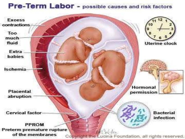 Preterm labor