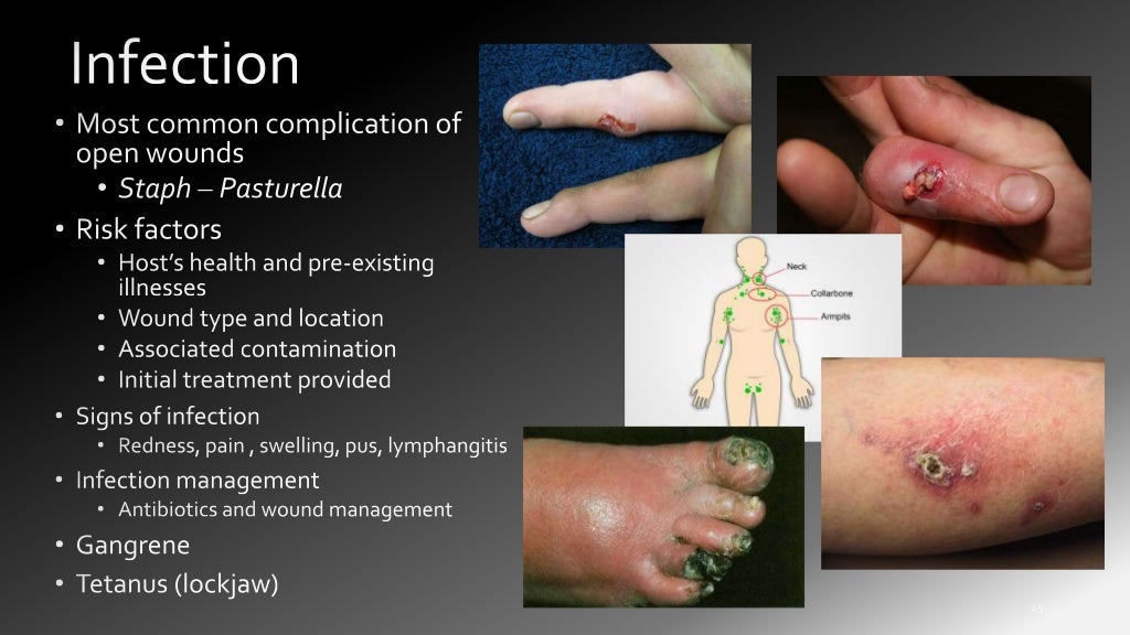Lacerations
