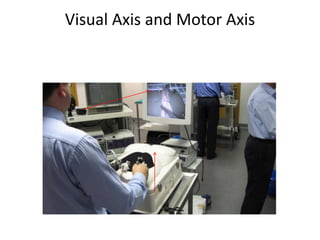 Visual Axis and Motor Axis
 
