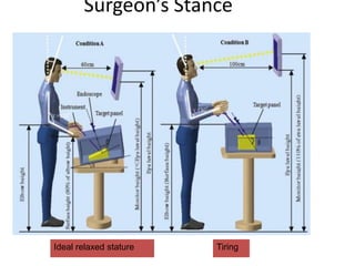 Surgeon’s Stance
Ideal relaxed stature Tiring
 
