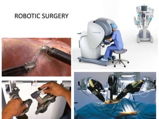 ROBOTIC SURGERY
 