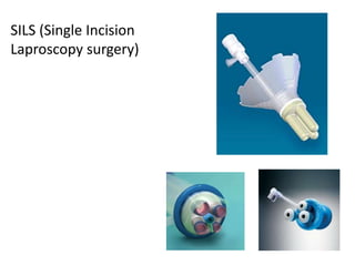 SILS (Single Incision
Laproscopy surgery)
 