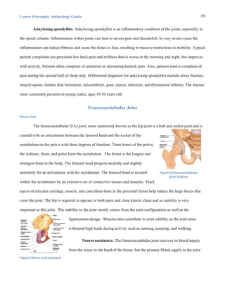 Lower Extremity Arthrology Guide 19	
  
Ankylosing spondylitis. Ankylosing spondylitis is an inflammatory condition of the joints, especially in
the spinal column. Inflammation within joints can lead to severe pain and discomfort. In very severe cases the
inflammation can induce fibrosis and cause the bones to fuse, resulting in massive restrictions to mobility. Typical
patient complaints are persistent low back pain and stiffness that is worse in the morning and night, but improves
with activity. Patients often complain of unilateral or alternating buttock pain. Also, patients tend to complain of
pain during the second half of sleep only. Differential diagnosis for ankylosing spondylitis include stress fracture,
muscle spasm, lumbar disk herniation, osteoarthritis, gout, cancer, infection, and rheumatoid arthritis. The disease
most commonly presents in young males, ages 15-30 years old.
Femoroacetabular Joint
Overview
The femoroacetabular (FA) joint, more commonly known as the hip joint is a ball and socket joint and is
created with an articulation between the femoral head and the socket of the
acetabulum on the pelvis with three degrees of freedom. Three bones of the pelvis;
the ischium, ilium, and pubis form the acetabulum. The femur is the longest and
strongest bone in the body. The femoral head projects medially and slightly
anteriorly for an articulation with the acetabulum. The femoral head is secured
within the acetabulum by an extensive set of connective tissues and muscles. Thick
layers of articular cartilage, muscle, and cancellous bone in the proximal femur help reduce the large forces that
cross the joint. The hip is required to operate in both open and close kinetic chain and so stability is very
important at this joint. The stability to the joint mostly comes from the joint configuration as well as the
ligamentous design. Muscles also contribute to joint stability as the joint must
withstand high loads during activity such as running, jumping, and walking.
Neurovasculature. The femoroacetabular joint receives its blood supply
from the artery to the head of the femur, but the primary blood supply to the joint
Figure	
  8	
  Femoroacetabular	
  
Joint	
  Surfaces
Figure	
  9	
  Bones	
  of	
  Acetabulum
 