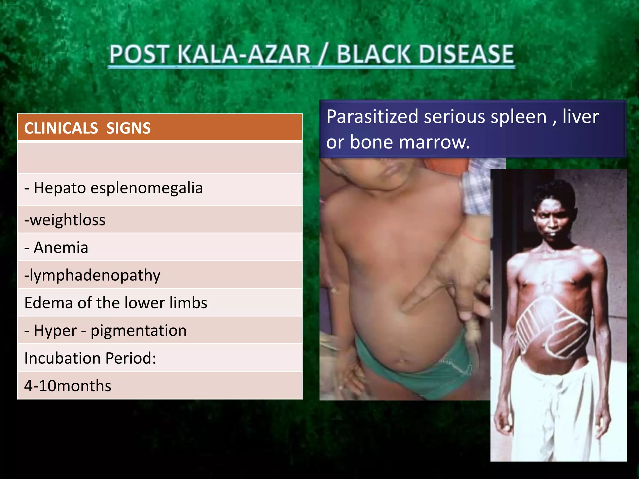 CLINICALS SIGNS
- Hepato esplenomegalia
-weightloss
- Anemia
-lymphadenopathy
Edema of the lower limbs
- Hyper - pigmentation
Incubation Period:
4-10months
Parasitized serious spleen , liver
or bone marrow.
 