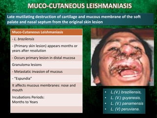 • L.(V.) braziliensis,
• L. (V.) guyanesis,
• L. (V.) panamensis
• L. (V) peruviana.
Late mutilating destruction of cartilage and mucous membrane of the soft
palate and nasal septum from the original skin lesion
Muco-Cutaneous Leishmaniasis
- L. brazilensis
- (Primary skin lesion) appears months or
years after resolution
- Occurs primary lesion in distal mucosa
Granuloma lesions
- Metastatic invasion of mucous
- “Espundia”
It affects mucous membranes: nose and
mouth
Incubations Periods:
Months to Years
 