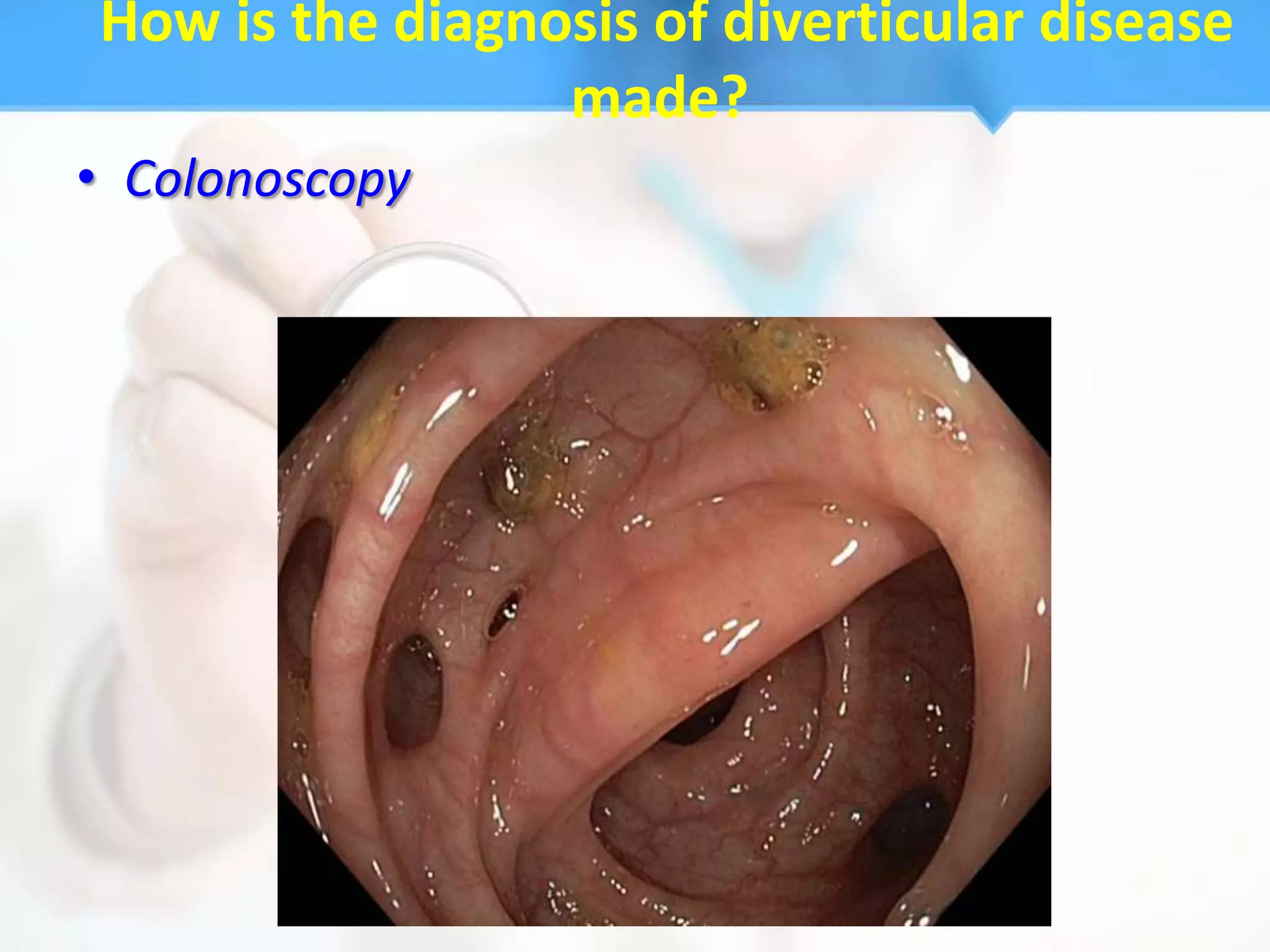 How is the diagnosis of diverticular disease
                 made?
• Colonoscopy
 