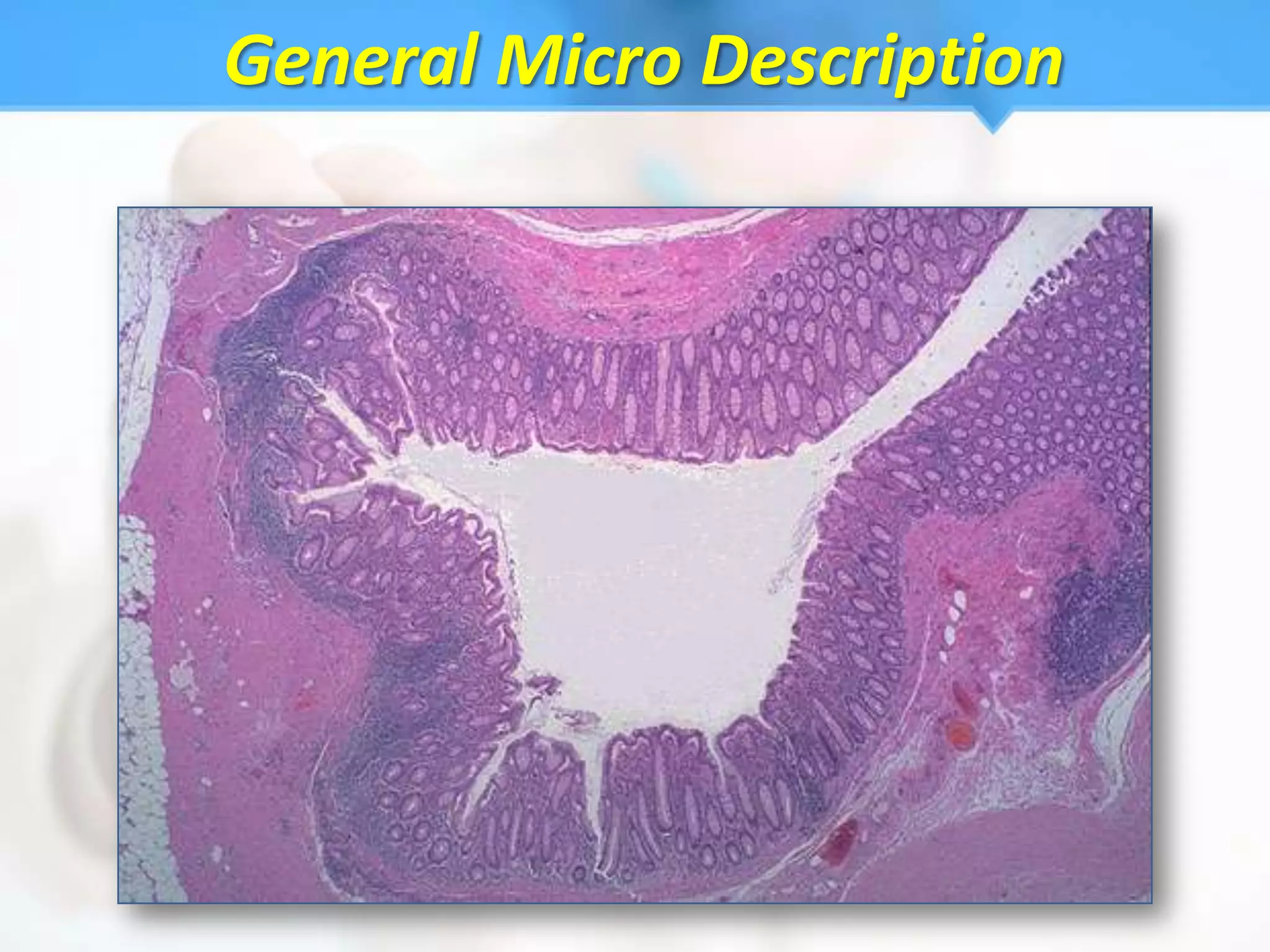 General Micro Description
 