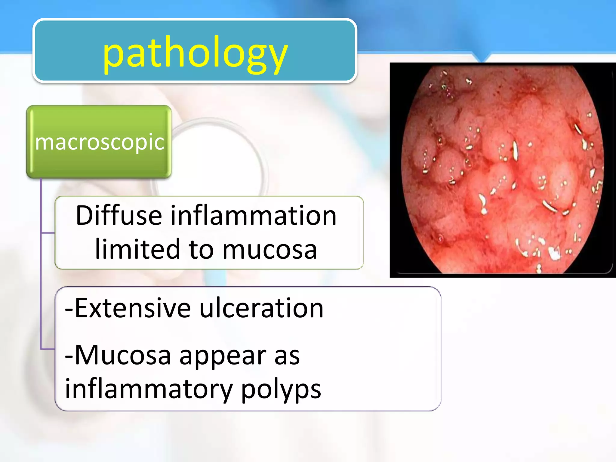 pathology
macroscopic

   Diffuse inflammation
    limited to mucosa
  -Extensive ulceration
  -Mucosa appear as
  inflammatory polyps
 