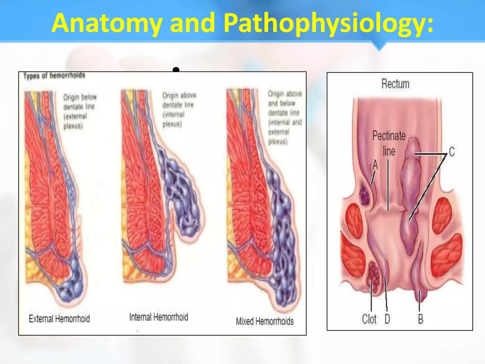 Anatomy and Pathophysiology:
        •
 
