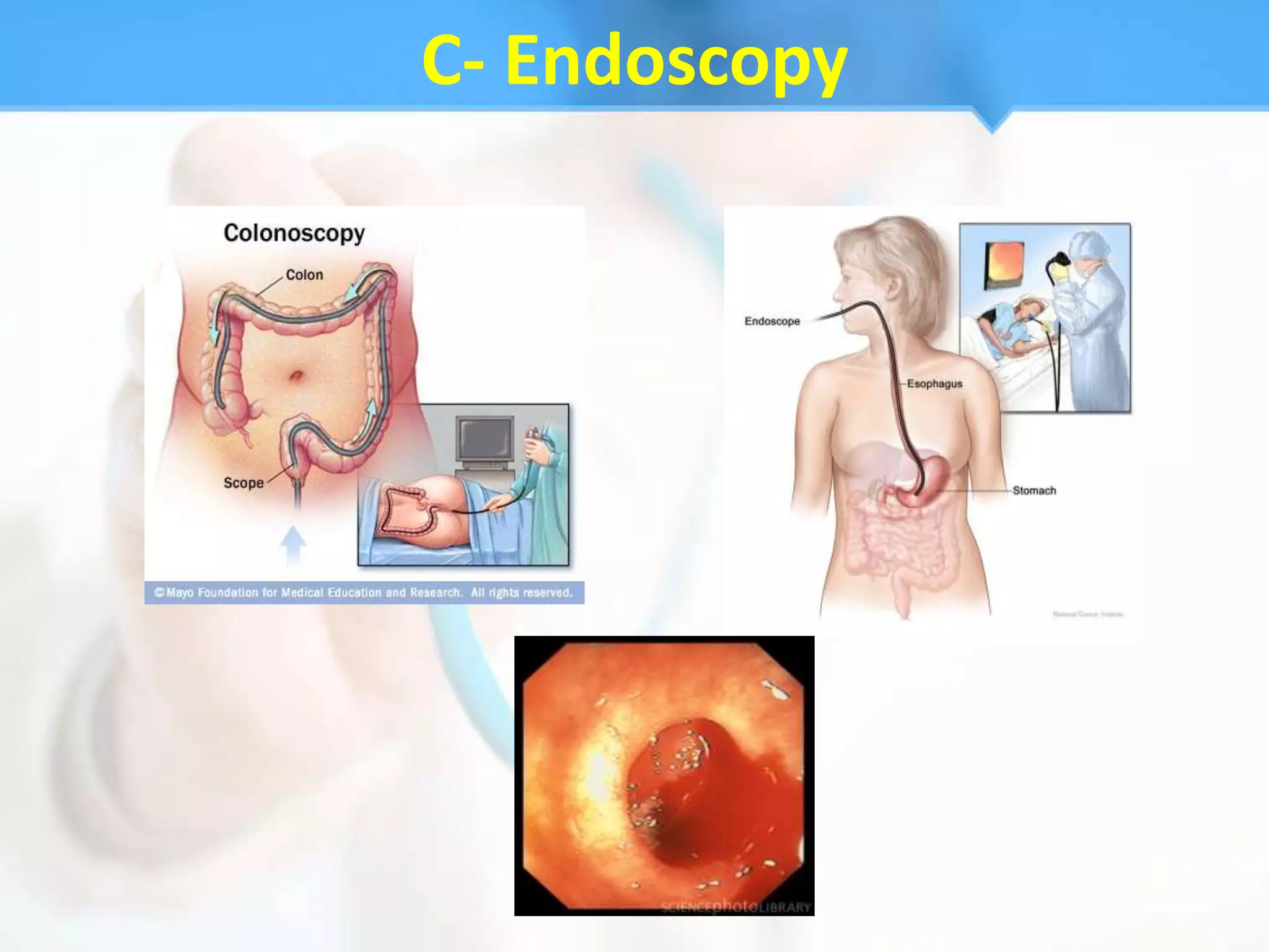 C- Endoscopy
 