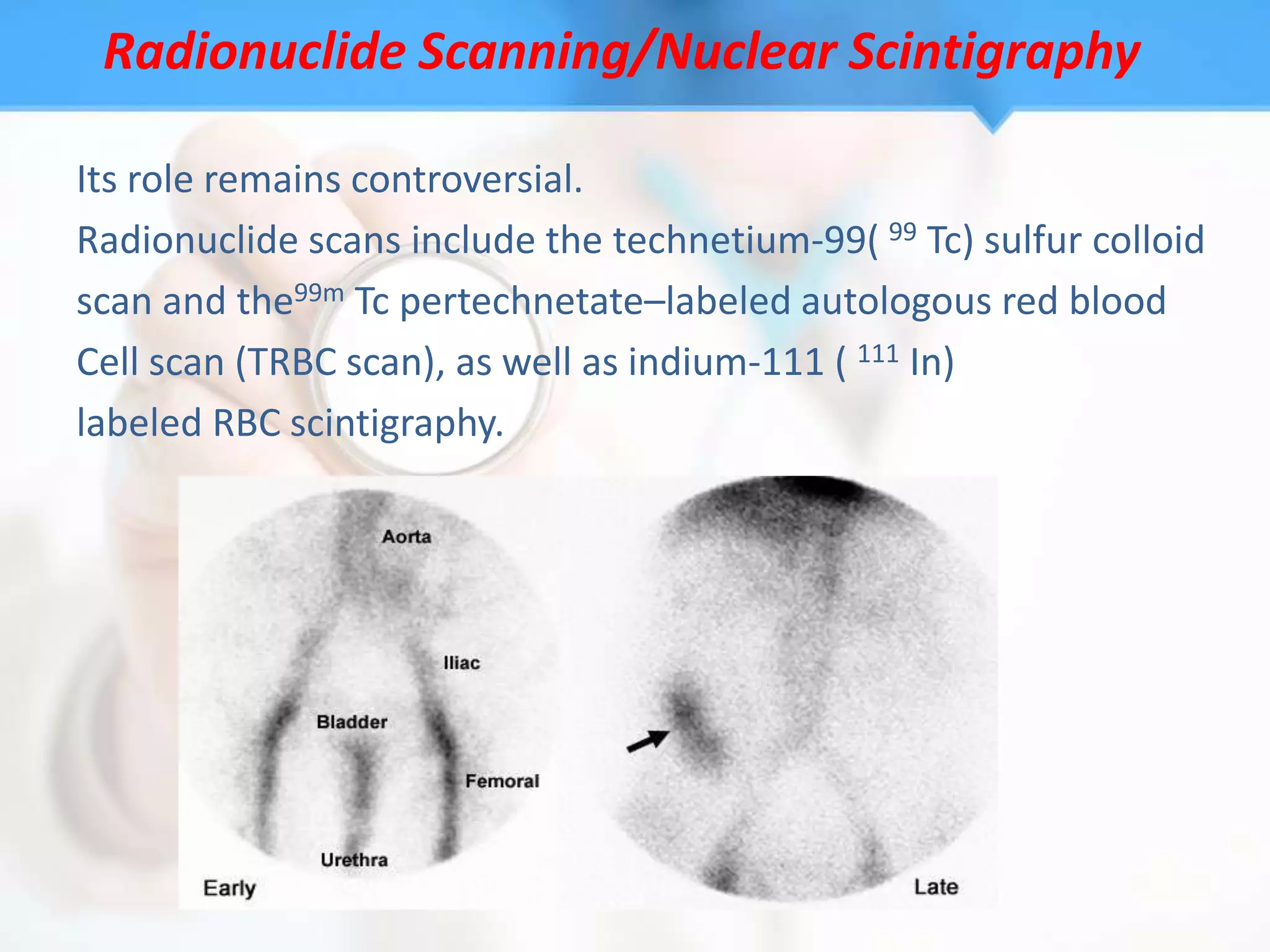 Radionuclide Scanning/Nuclear Scintigraphy

Its role remains controversial.
Radionuclide scans include the technetium-99( 99 Tc) sulfur colloid
scan and the99m Tc pertechnetate–labeled autologous red blood
Cell scan (TRBC scan), as well as indium-111 ( 111 In)
labeled RBC scintigraphy.
 