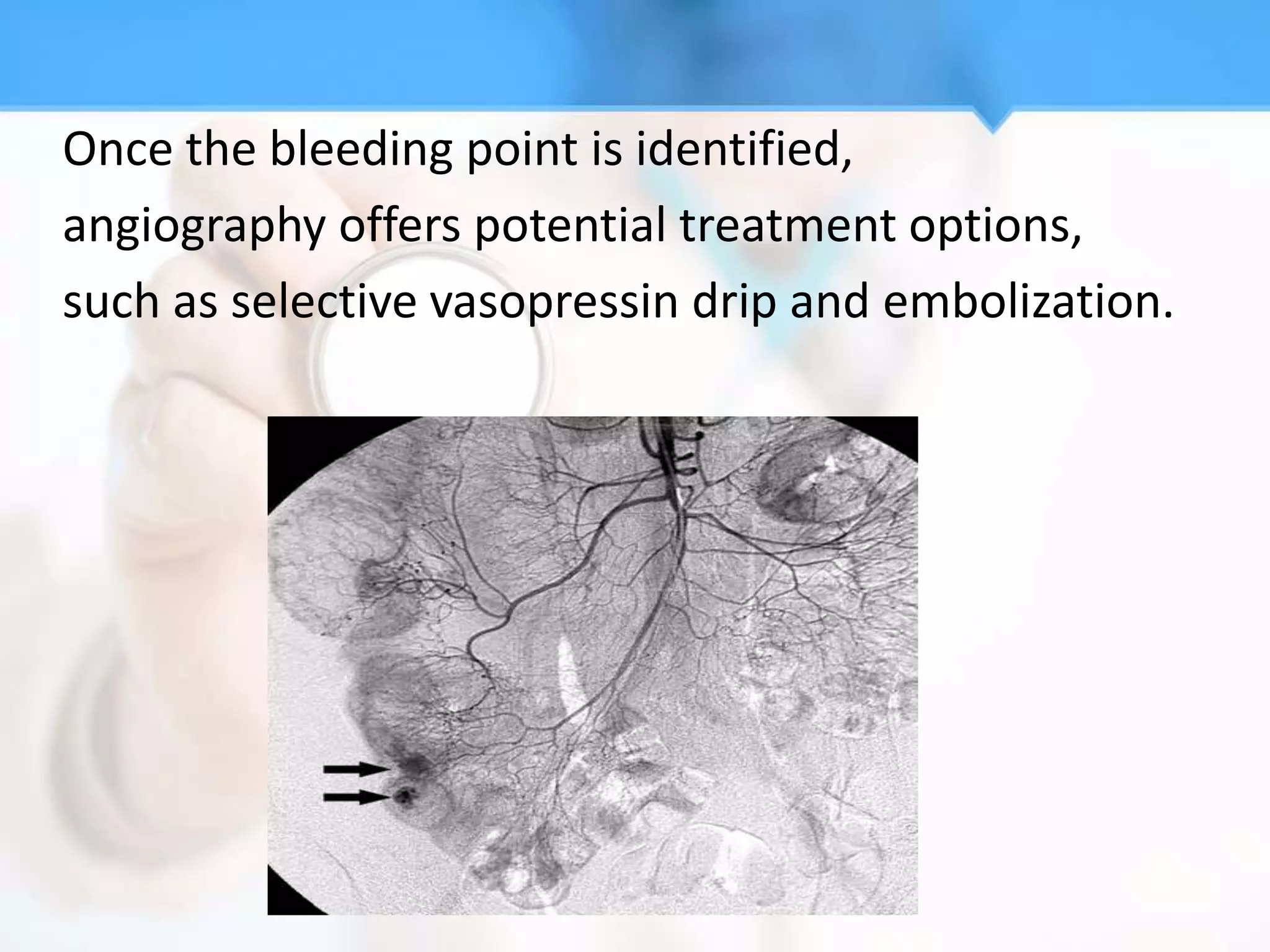 Once the bleeding point is identified,
angiography offers potential treatment options,
such as selective vasopressin drip and embolization.
 