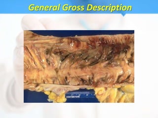 General Gross Description
 