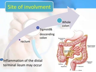 Site of involvment

                                     Whole
                                     colon
                        Sigmoid&
                        descending
                        colon
           rectum




Inflammation of the distal
terminal ileum may occur
 