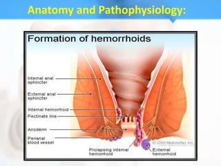 Anatomy and Pathophysiology:
 