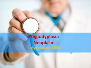 Angiodyplasia
 Neoplasm
Aya shawky (289)
 