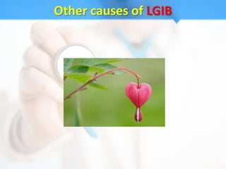 Other causes of LGIB
 