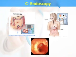C- Endoscopy
 