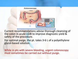 Current recommendations advise thorough cleansing of
the colon in acute LGIB to improve diagnostic yield &
safety of the procedure.
For optimal purge, the pt. takes 3-6 L of a polyethylene
glycol-based solution.

While in pts with severe bleeding, urgent colonoscopy
must sometimes be carried out without purge.
 