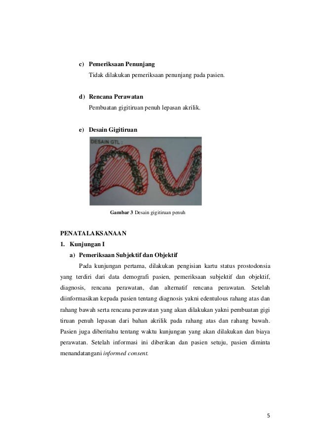 penatalaksanaan gigitiruan penuh lepasan  pasien