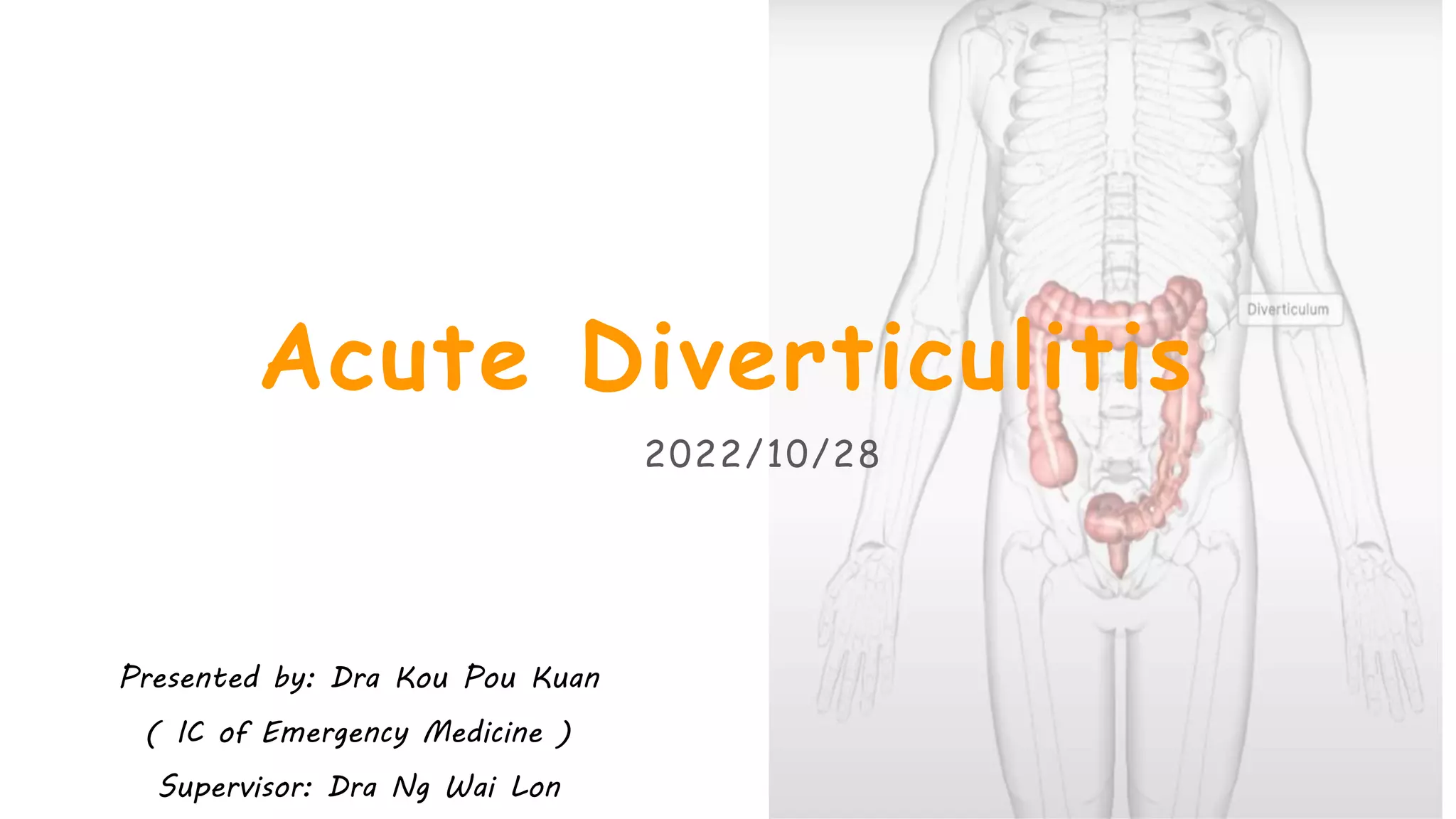 Acute Diverticulitis.pptx