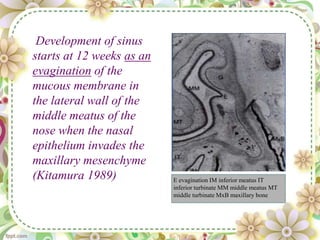 Development of sinus
starts at 12 weeks as an
evagination of the
mucous membrane in
the lateral wall of the
middle meatus of the
nose when the nasal
epithelium invades the
maxillary mesenchyme
(Kitamura 1989) E evagination IM inferior meatus IT
inferior turbinate MM middle meatus MT
middle turbinate MxB maxillary bone
 
