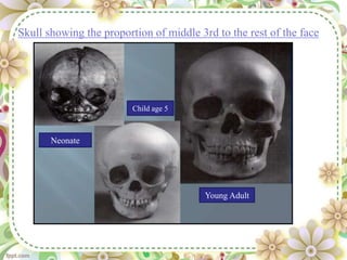 Skull showing the proportion of middle 3rd to the rest of the face
Neonate
Child age 5
Young Adult
 