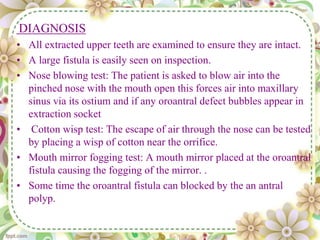 DIAGNOSIS
• All extracted upper teeth are examined to ensure they are intact.
• A large fistula is easily seen on inspection.
• Nose blowing test: The patient is asked to blow air into the
pinched nose with the mouth open this forces air into maxillary
sinus via its ostium and if any oroantral defect bubbles appear in
extraction socket
• Cotton wisp test: The escape of air through the nose can be tested
by placing a wisp of cotton near the orrifice.
• Mouth mirror fogging test: A mouth mirror placed at the oroantral
fistula causing the fogging of the mirror. .
• Some time the oroantral fistula can blocked by the an antral
polyp.
 
