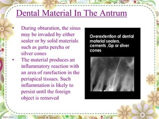 Dental Material In The Antrum
• During obturation, the sinus
may be invaded by either
sealer or by solid materials
such as gutta percha or
silver cones
• The material produces an
inflammatory reaction with
an area of rarefaction in the
periapical tissues. Such
inflammation is likely to
persist until the foreign
object is removed
 