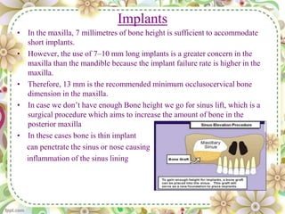 Implants
• In the maxilla, 7 millimetres of bone height is sufficient to accommodate
short implants.
• However, the use of 7–10 mm long implants is a greater concern in the
maxilla than the mandible because the implant failure rate is higher in the
maxilla.
• Therefore, 13 mm is the recommended minimum occlusocervical bone
dimension in the maxilla.
• In case we don’t have enough Bone height we go for sinus lift, which is a
surgical procedure which aims to increase the amount of bone in the
posterior maxilla
• In these cases bone is thin implant
can penetrate the sinus or nose causing
inflammation of the sinus lining
 