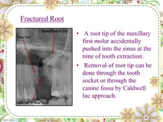 Fractured Root
• A root tip of the maxillary
first molar accidentally
pushed into the sinus at the
time of tooth extraction.
• Removal of root tip can be
done through the tooth
socket or through the
canine fossa by Caldwell
luc approach.
 