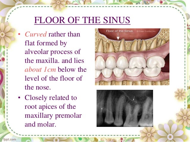 Maxillary Sinus Seminar