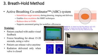 Motion Management in Radiation Therapy | PDF
