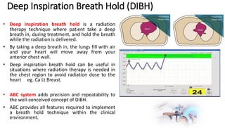 Motion Management in Radiation Therapy | PDF