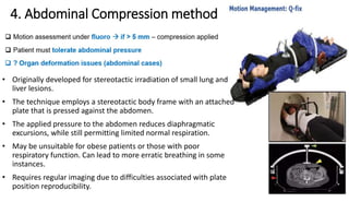 Motion Management in Radiation Therapy | PDF