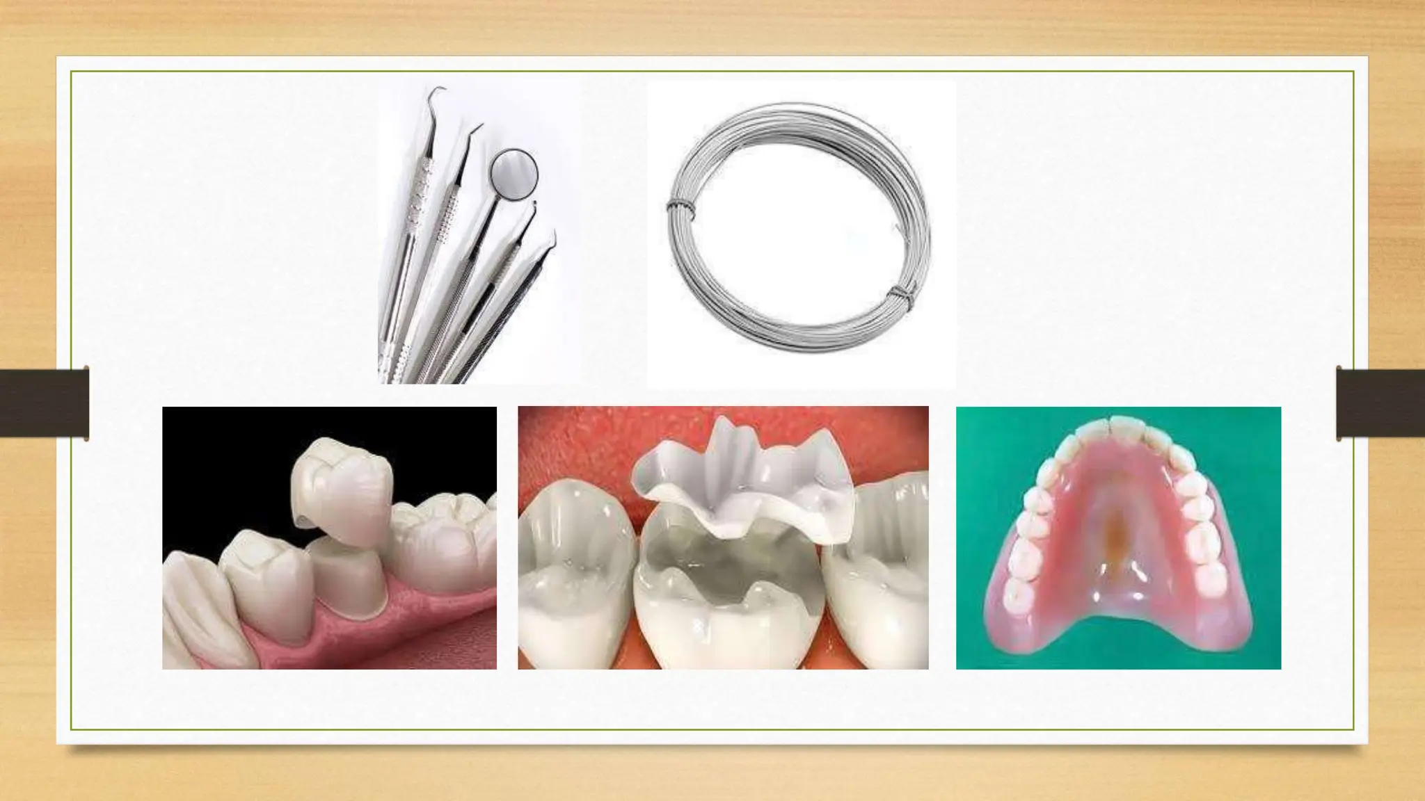 Metal and Alloys Applied Dental Materials PPT