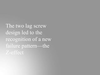 The two lag screw
design led to the
recognition of a new
failure pattern—the
Z-effect
 
