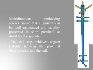 Multidirectional interlocking
screws ensure that alignment can
be well maintained and stability
preserved in short proximal or
distal tibial segments
The end cap achieves angular
stability between the proximal
oblique screw and the nail.
 