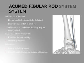 ACUMED FIBULAR ROD
SYSTEM
ORIF of ankle fractures
Deep wound infection (elderly, diabetics)
Hardware discomfort & irriation.
Often the skin / soft tissue. Envelop may be
compromised.
ACUMED fibular rod system:
Excellent fracture stability
Minimally invasive
Indications:
Lateral mallelor fracture
Unstable ankle fractures with talar subluxation.
 