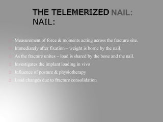 THE TELEMERIZED
NAIL:
Measurement of force & moments acting across the fracture site.
Immediately after fixation – weight is borne by the nail.
As the fracture unites – load is shared by the bone and the nail.
Investigates the implant loading in vivo
Influence of posture & physiotherapy
Load changes due to fracture consolidation
 
