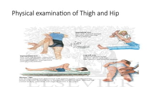 Physical examination of Thigh and Hip
 