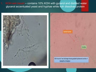 1. KOH wet mount – contains 10% KOH with gycerol and distilled water
glycerol accentuated yeast and hyphae while koh dissolves protein
 