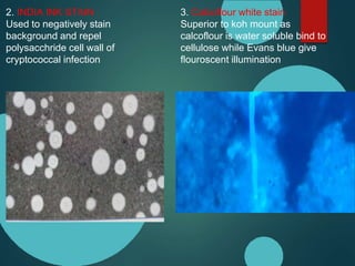 2. INDIA INK STAIN
Used to negatively stain
background and repel
polysacchride cell wall of
cryptococcal infection
3. Calcoflour white stain
Superior to koh mount as
calcoflour is water soluble bind to
cellulose while Evans blue give
flouroscent illumination
 