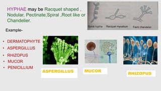 HYPHAE may be Racquet shaped ,
Nodular, Pectinate,Spiral ,Root like or
Chandelier.
Example-
• DERMATOPHYTE
• ASPERGILLUS
• RHIZOPUS
• MUCOR
• PENICILLIUM
ASPERGILLUS MUCOR
RHIZOPUS
 